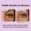 image:imageVibriance Eye Renewal Serum for Mature Skin  Dark Circles Puffiness amp Fine Lines Treatment  6 Advanced Ingredients with Caffeine amp Hyaluronic Acid